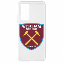 Xiaomi Mi 10T/10T Pro