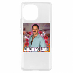 Xiaomi Mi11