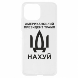 Xiaomi Mi11 Lite