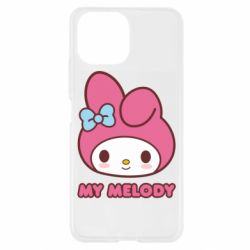 Xiaomi Mi11 Lite