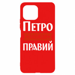 Xiaomi Mi11 Lite