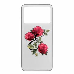 Xiaomi Poco X4 Pro 5G