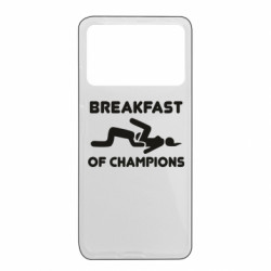 Xiaomi Poco X4 Pro 5G