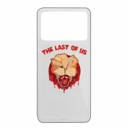 Чехол из раздела Авторские принты The Last Of Us щелкун для Xiaomi Poco X4 Pro 5G - FATLINE Чехол из раздела Авторские принты The Last Of Us щелкун для Xiaomi Poco X4 Pro 5G