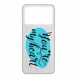 Xiaomi Poco X4 Pro 5G