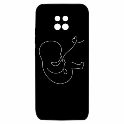 Xiaomi Redmi 10X 5G