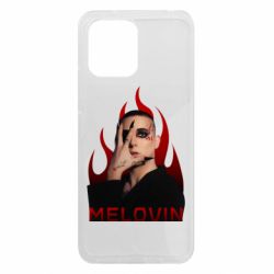 Xiaomi Redmi 12 - FATLINE