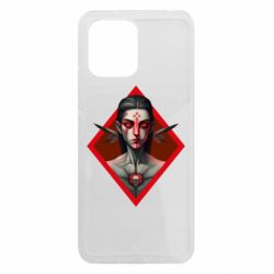 Xiaomi Redmi 12 - FATLINE