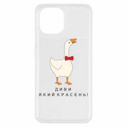 Xiaomi Redmi A1