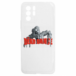 Чохол з розділу Lady Gaga Lady Gaga Dead Dance для Xiaomi Redmi Note 10 5G - FATLINE Чохол з розділу Lady Gaga Lady Gaga Dead Dance для Xiaomi Redmi Note 10 5G