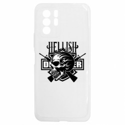 Xiaomi Redmi Note 10 5G