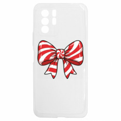 Xiaomi Redmi Note 10 5G