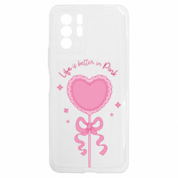 Xiaomi Redmi Note 10 5G