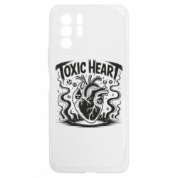 Xiaomi Redmi Note 10 5G