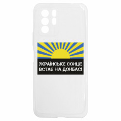 Xiaomi Redmi Note 10 5G