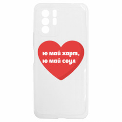 Xiaomi Redmi Note 10 5G