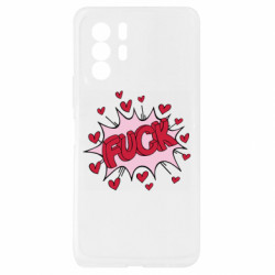 Xiaomi Redmi Note 10 Pro 5G