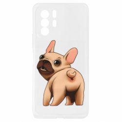 Xiaomi Redmi Note 10 Pro 5G
