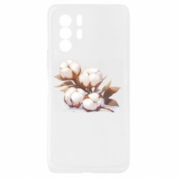 Xiaomi Redmi Note 10 Pro 5G