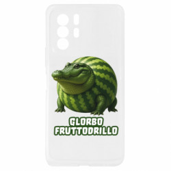 Xiaomi Redmi Note 10 Pro 5G