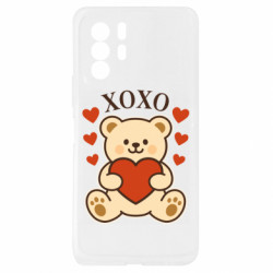 Xiaomi Redmi Note 10 Pro 5G