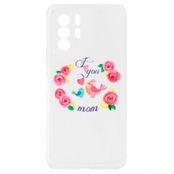 Xiaomi Redmi Note 10 Pro 5G