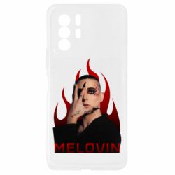 Xiaomi Redmi Note 10 Pro 5G