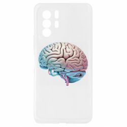 Xiaomi Redmi Note 10 Pro 5G
