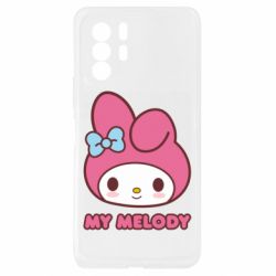 Xiaomi Redmi Note 10 Pro 5G