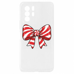 Xiaomi Redmi Note 10 Pro 5G