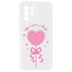 Xiaomi Redmi Note 10 Pro 5G