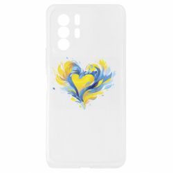 Xiaomi Redmi Note 10 Pro 5G