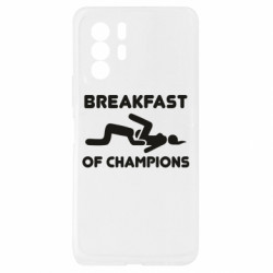 Xiaomi Redmi Note 10 Pro 5G