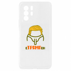 Xiaomi Redmi Note 10 Pro 5G