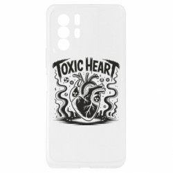 Xiaomi Redmi Note 10 Pro 5G