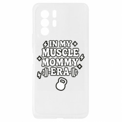 Xiaomi Redmi Note 10 Pro 5G