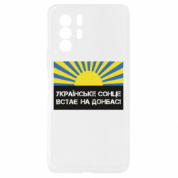 Xiaomi Redmi Note 10 Pro 5G