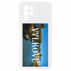 Xiaomi Redmi Note 10 Pro 5G