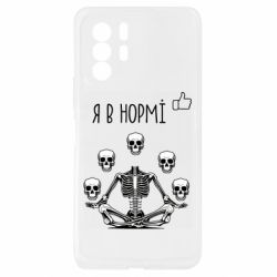 Xiaomi Redmi Note 10 Pro 5G
