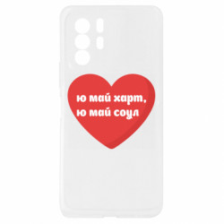 Xiaomi Redmi Note 10 Pro 5G