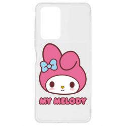 Xiaomi Redmi Note 10 Pro