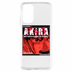 Xiaomi Redmi Note 11