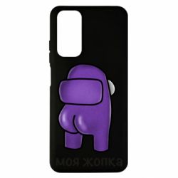 Xiaomi Redmi Note 11