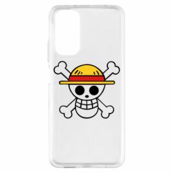 Xiaomi Redmi Note 11