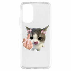 Xiaomi Redmi Note 11