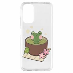 Xiaomi Redmi Note 11