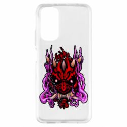 Xiaomi Redmi Note 11