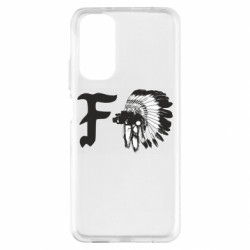 Xiaomi Redmi Note 11