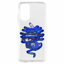 Xiaomi Redmi Note 11