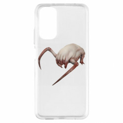 Xiaomi Redmi Note 11